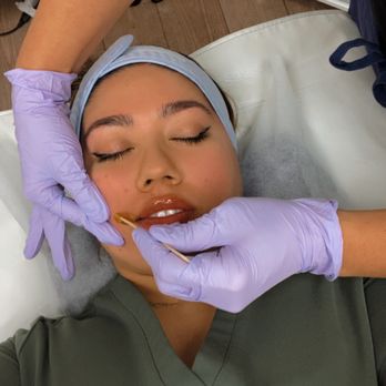 Irises Beauty - Upper Lip Waxing - Skin Care Near Me - San Jose, California Irises Beauty - Upper Lip Waxing - Skin Care Near Me - San Jose, California