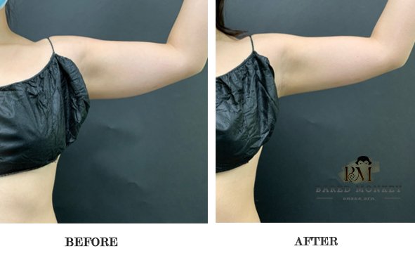 Bared Monkey Laser Spa by null