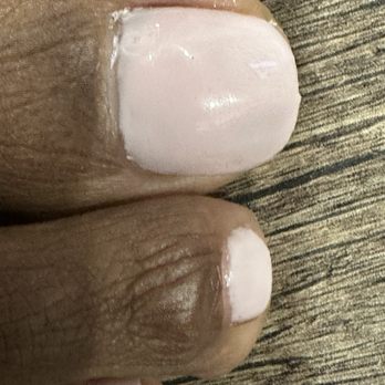 Lovely Nails - Look at big toe cuticle area... sloppy job! - Nail Salons Near Me - Bryant, Arkansas