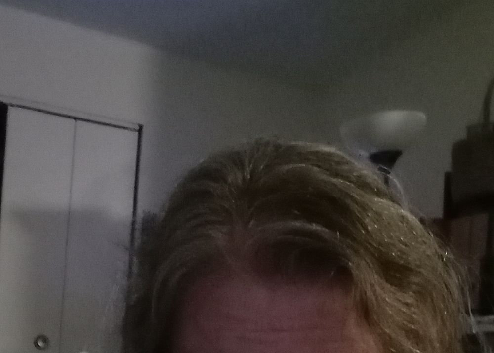 LASER HAIR & SCALP CLINIC Updated September 2024 13555 Automobile