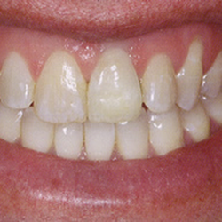 Plainsboro Dental Services