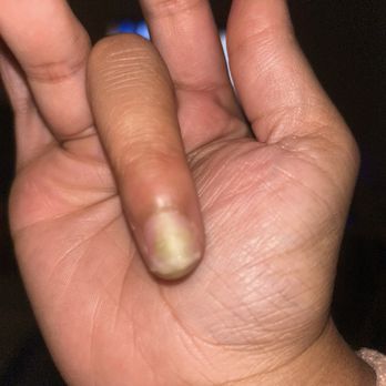 MH Gel Nails Beauty - Infection - Nail Salons Near Me - Long Beach, California