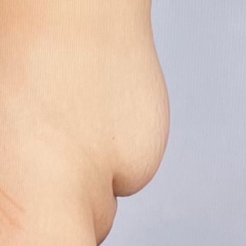 Pat Pazmino, MD - Before ( 29dec2022) - Cosmetic Surgeons Near Me - Miami, Florida Pat Pazmino, MD - Before ( 29dec2022) - Cosmetic Surgeons Near Me - Miami, Florida