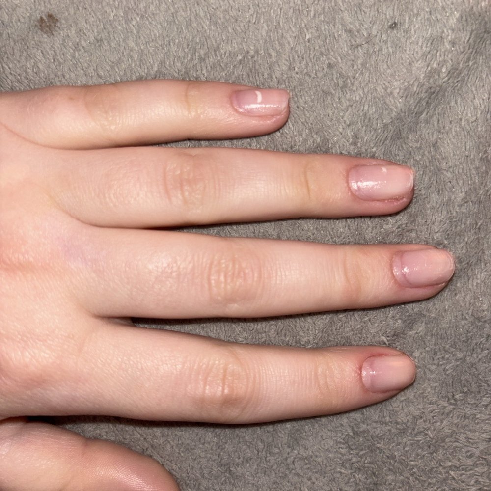 This is what my nails look like after 2 hours of taking off their acrylics