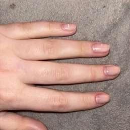 This is what my nails look like after 2 hours of taking off their acrylics