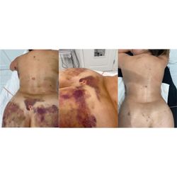 Transformation Studios & Beauty Spa - PostOp Care