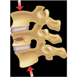 Georgetown Interventional Pain
