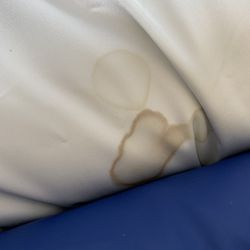 University of Washington Medical Center - Chelsea's bedding was covered with dried blood and pus for most of the last 7 months of her life.