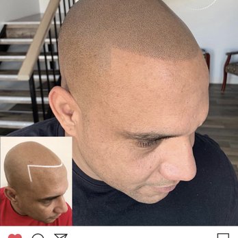 Hairline Studios - Hair Loss Centers Near Me - Orlando, Florida Hairline Studios - Hair Loss Centers Near Me - Orlando, Florida