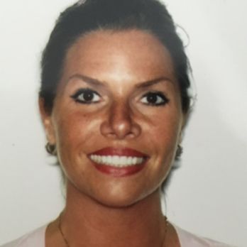 Select Dental and Orthodontics - 2005 TopFront Veneers @ 6 years later..beautiful job, by Dean Salo, DDS, Marina Del Rey, CA, Cosmetic Dental Excellence A+ Los Angeles, CA - General Dentistry Near Me - Torrance, California Select Dental and Orthodontics - 2005 TopFront Veneers @ 6 years later..beautiful job, by Dean Salo, DDS, Marina Del Rey, CA, Cosmetic Dental Excellence A+ Los Angeles, CA - General Dentistry Near Me - Torrance, California