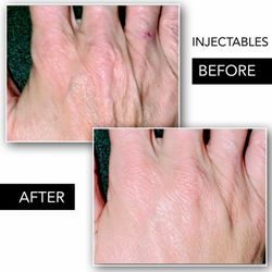 KMP Aesthetics - Kevan Petterson, DNP, ARNP
