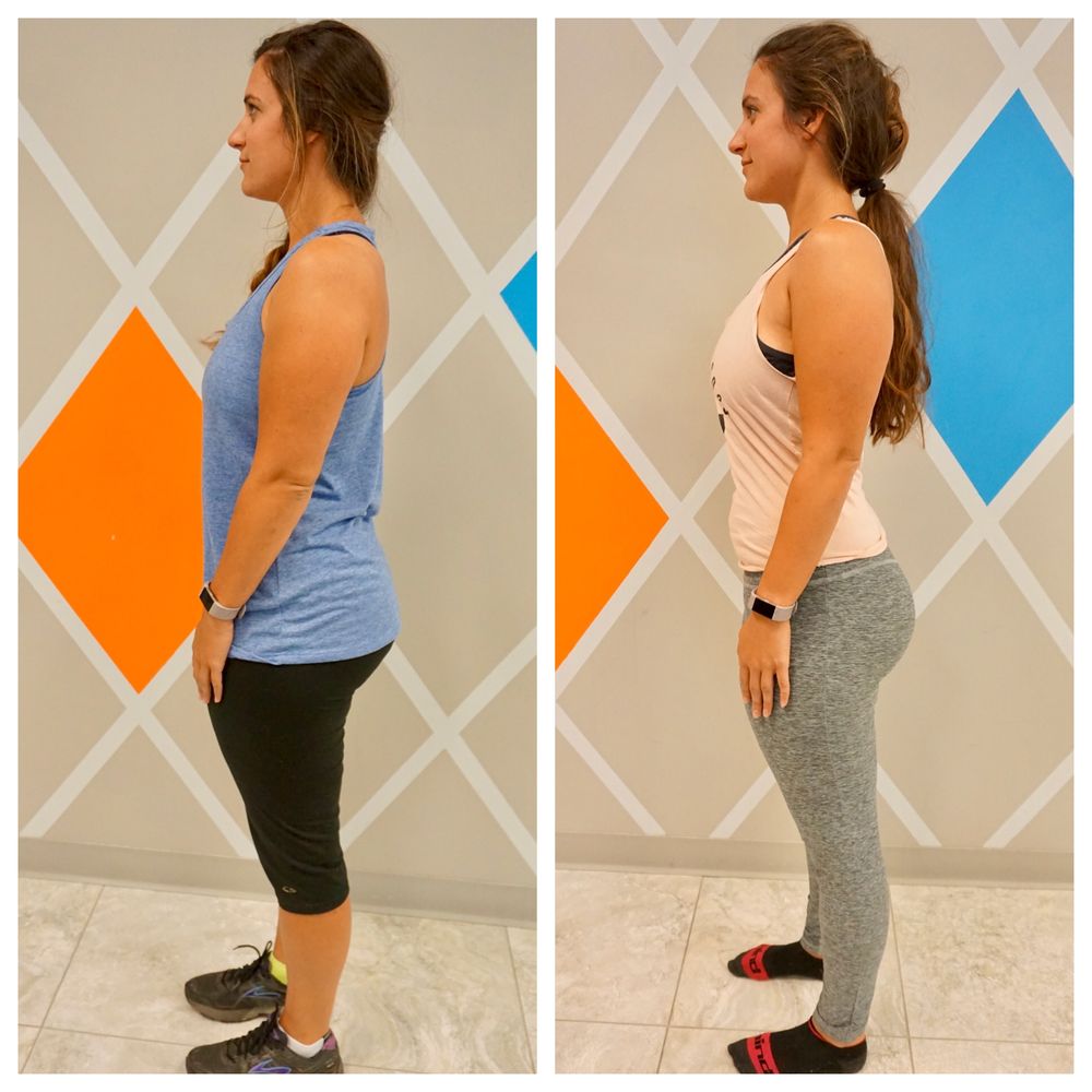 TEMECULAS WEIGHT LOSS TRANSFORMATION Updated April 2024 58 Photos