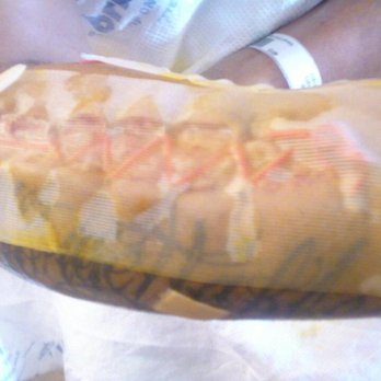 Calvon Voong, MD - Upper right forearm - Pain Management Near Me - Visalia, California