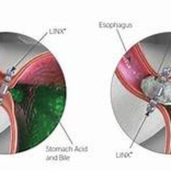 BAY AREA SURGICAL SPECIALISTS - Updated January 2025 - 11 Photos 