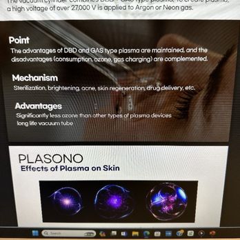 Irene's Skintopia - Look at these wands and look at NuDerma high frequency wands - Skin Care Near Me - Los Angeles, California Irene's Skintopia - Look at these wands and look at NuDerma high frequency wands - Skin Care Near Me - Los Angeles, California