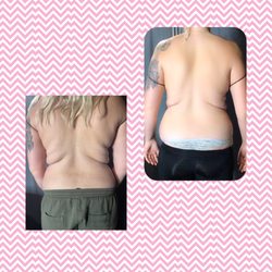 Love your body by Luz Body Sculpting