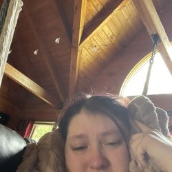 James K Homrighausen, DMD - Day of while waiting for pain meds to be filled. 20/10 pain.