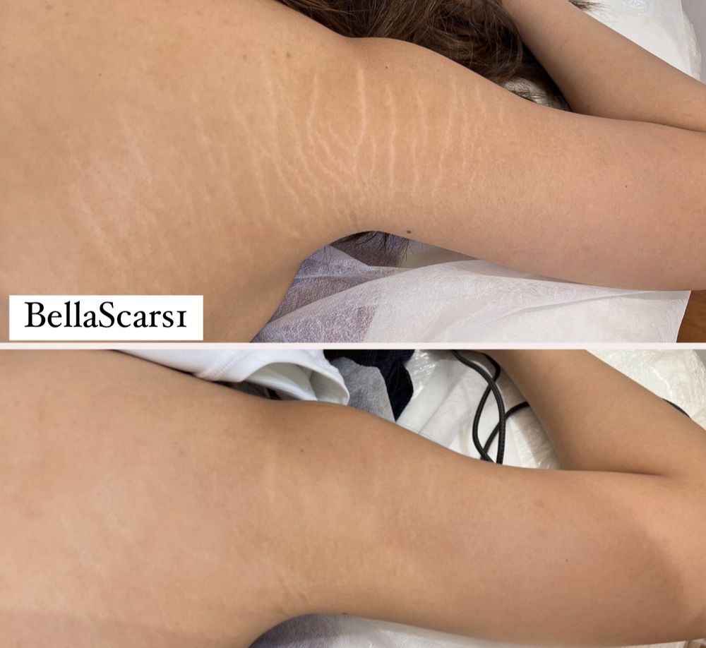 Bellascars Logo