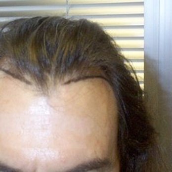 Jae Pak, M.D - Hair Loss Centers Near Me - Los Angeles, California