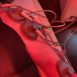 Electrical Stimulation