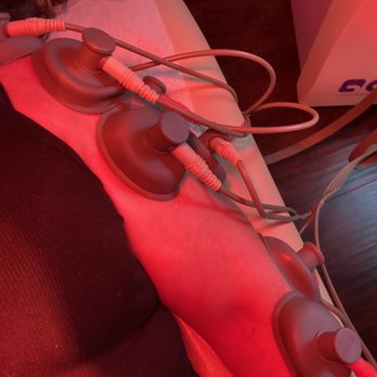 Forest Acupuncture - Electrical Stimulation - Acupuncture Near Me - La Crescenta-Montrose, California
