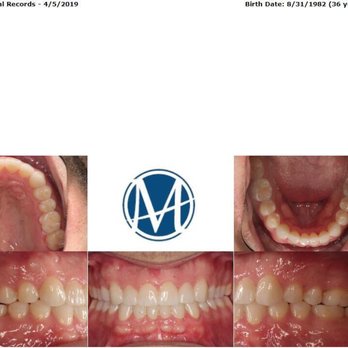 MacGinnis Orthodontics - The final product!!! Amazing!!! - Orthodontists Near Me - Fullerton, California
