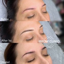 iBROW CLINIQ - 4D Combo brows's healed one. (Before touchup)