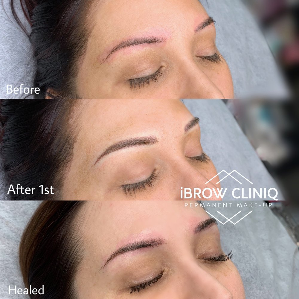 iBROW CLINIQ Logo