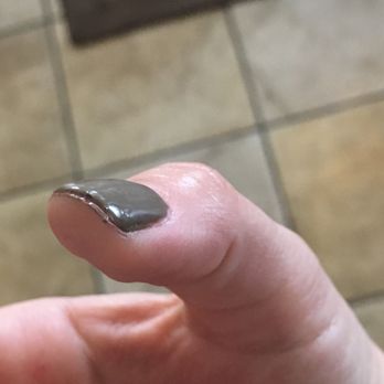 On LA Nails - Jagged nails and gel stuck to my skin. - Nail Salons Near Me - Los Angeles, California On LA Nails - Jagged nails and gel stuck to my skin. - Nail Salons Near Me - Los Angeles, California