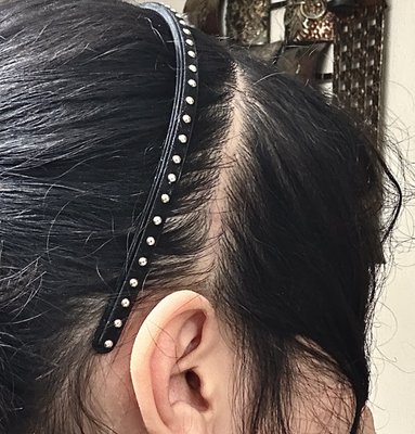 BEVERLY HILLS TRANSGENDER SURGERY: DR. ALEXANDER SINCLAIR - Updated ...