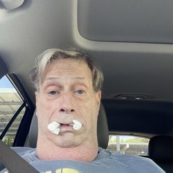 Johnson Miin DDS - I did very well after my tooth extraction!