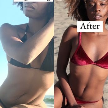LA Body Contouring - Medical Spas Near Me - Encino, California LA Body Contouring - Medical Spas Near Me - Encino, California