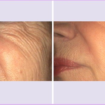 Dallas Medical Aesthetics - Wrinkle Reduction - Medical Spas Near Me - Dallas, Texas