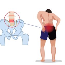 Painless Trigger Point Therapy - tightness in lumbar spine causing low back pain