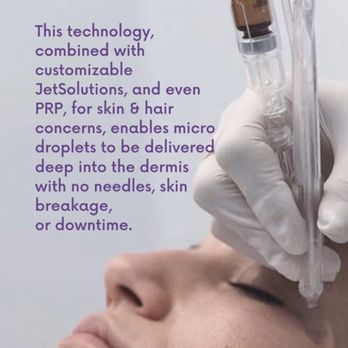 Beautiful By Bri - What is a jetpeel? - Medical Spas Near Me - Beverly, Massachusetts Beautiful By Bri - What is a jetpeel? - Medical Spas Near Me - Beverly, Massachusetts