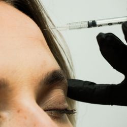 Valley Wellness & Aesthetics - Neurotoxin with Botox or Dysport