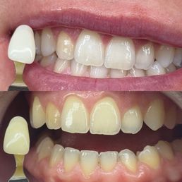 Before & After Before & After