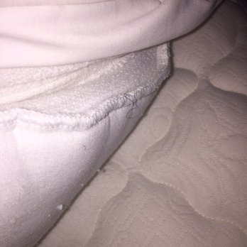 Zoom The Pic You Will See A Pubic Hair Yelp