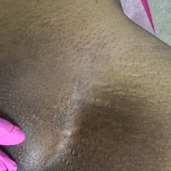Xposure Home Waxing - Manzilian Waxing