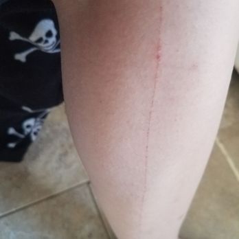 H&M - From knee to almost ankle cut from big round store tac that was in the right pants pocket of the pants I tried on - Women's Clothing Near Me - Trumbull, Connecticut