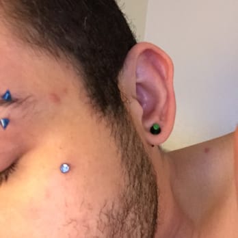 Bombshell BodyWorks - This is the dermal she did on me absolutely love it - Piercing Near Me - Greeley, Colorado