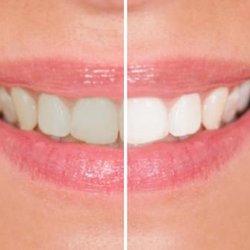 Alan S Yeung, DDS - Untitled
