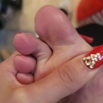 MJ Nails Spa - Bad pedicure - Nail Salons Near Me - Henderson, Nevada
