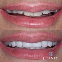 JJ Dental
