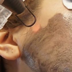 Atelier Sav - Whitening,lifting and cleaning pigmentations dark spots