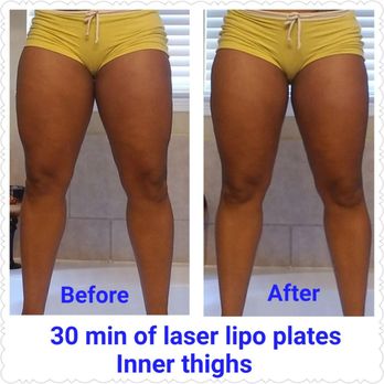 Bodies Made By Bri - No down time and no surgery. - Body Contouring Near Me - Missouri City, Texas Bodies Made By Bri - No down time and no surgery. - Body Contouring Near Me - Missouri City, Texas