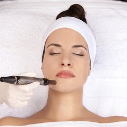 Uderma Spa - Microneedling fractional treatments