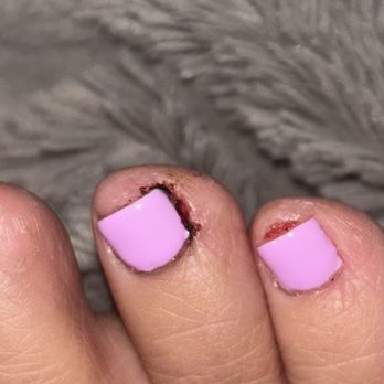 Deja Vu Nail Spa - Cuts on my toes - Nail Salons Near Me - Sebastopol, California Deja Vu Nail Spa - Cuts on my toes - Nail Salons Near Me - Sebastopol, California