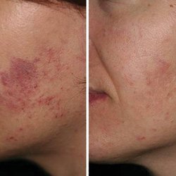 Dermatology & Skin Care Associates