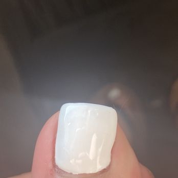 Rose’s Nails - acrylic overlay on big toe - Nail Salons Near Me - Grand Terrace, California Rose’s Nails - acrylic overlay on big toe - Nail Salons Near Me - Grand Terrace, California